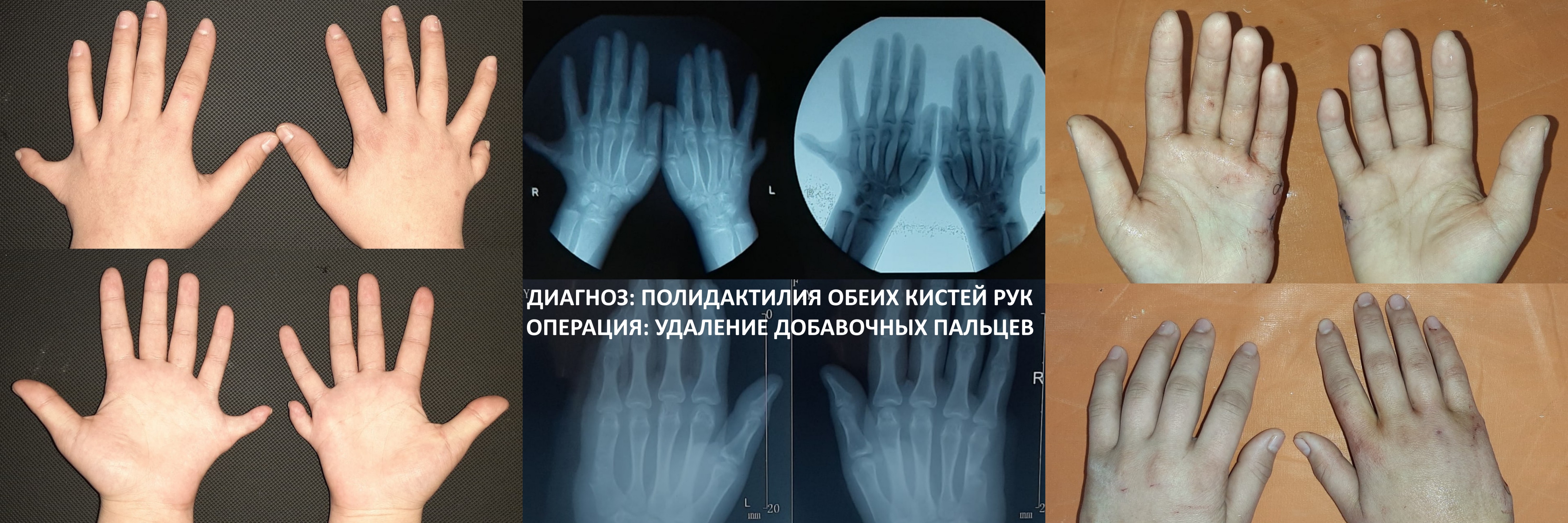 НИИ ТРАВМАТОЛОГИИ И ОРТОПЕДИИ